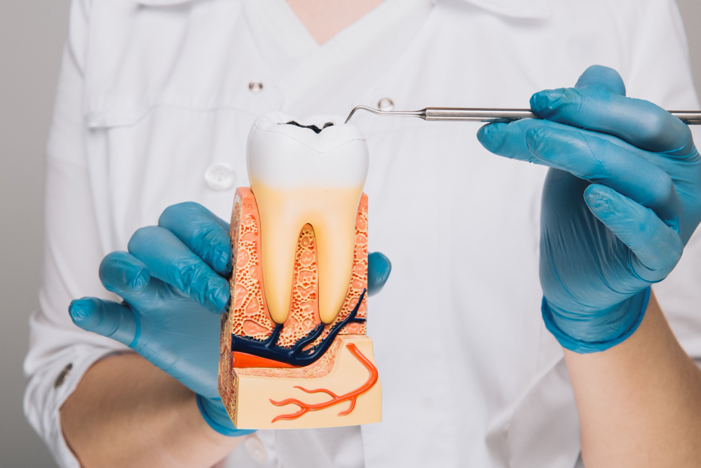 man showing tooth model about root canal treatment