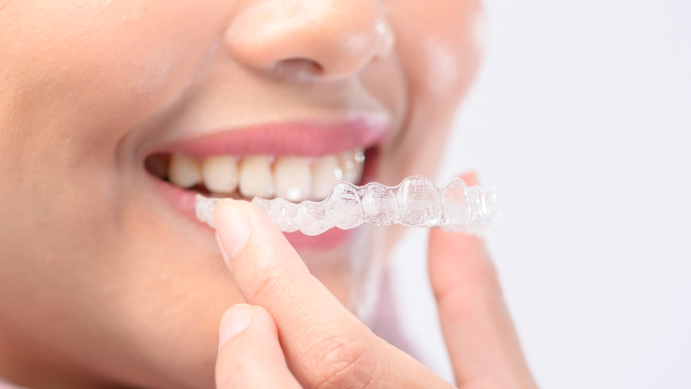 woman wearing invisalign